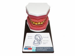 Демонстрационная модель "Ротовая полость курильщика" - fgospostavki.ru - Воронеж